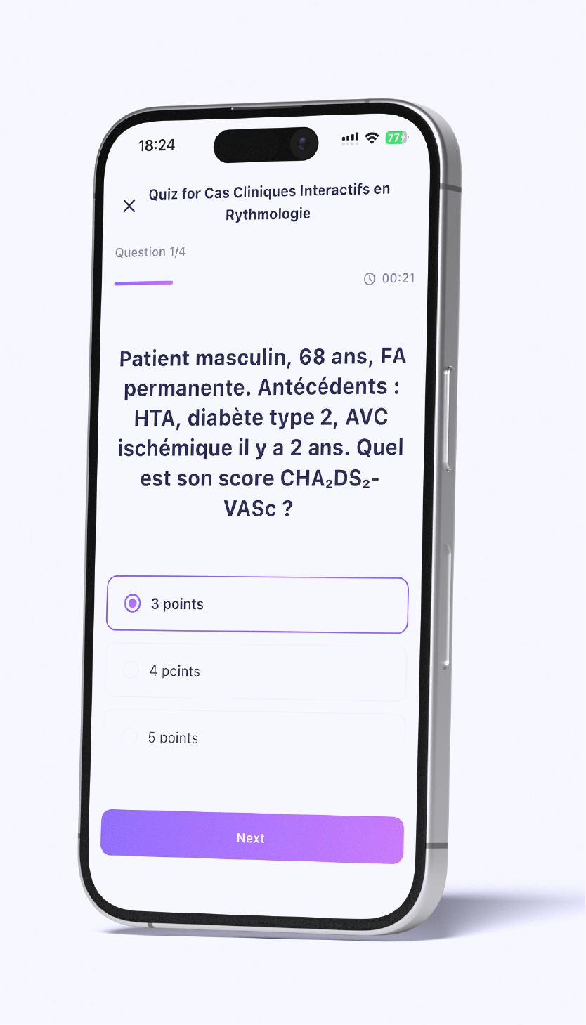 Interface Q&A et quiz Connect